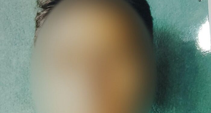 Detuvieron en Bolivia a un hombre acusado de abusar sexualmente de su hija