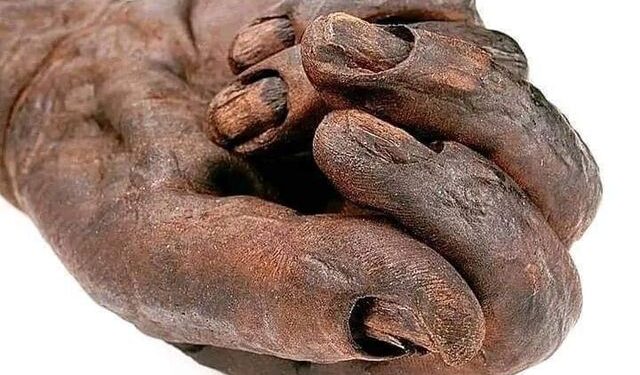 Esto no es una mano de madera tallada sino parte de un cadáver