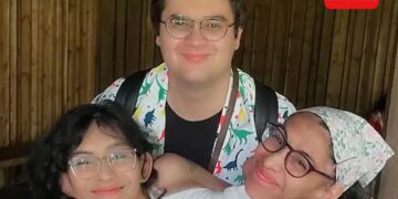 Carmen y Lupita, las siamesas, responden a preguntas sobre su vida sexual