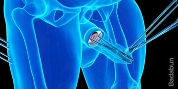 Tres datos de la circuncisión que toda mujer debe saber