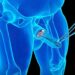 Tres datos de la circuncisión que toda mujer debe saber