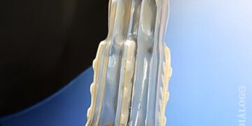 Una mujer inventó un condón «antiviolación»