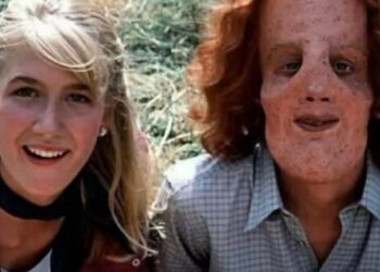 El chico que demostró que la belleza no es solo externa