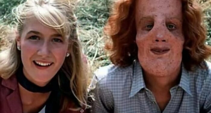 El chico que demostró que la belleza no es solo externa