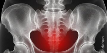 Cada vez más son los hombres diagnosticados con cáncer de próstata