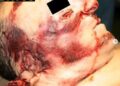 La fuerza de la naturaleza: ¿Cómo actúan los rayos en el cuerpo humano?