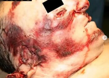 La fuerza de la naturaleza: ¿Cómo actúan los rayos en el cuerpo humano?