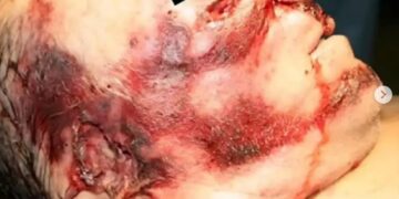 La fuerza de la naturaleza: ¿Cómo actúan los rayos en el cuerpo humano?